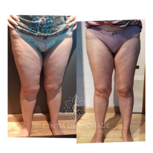 ANTES-E-DEPOIS-1