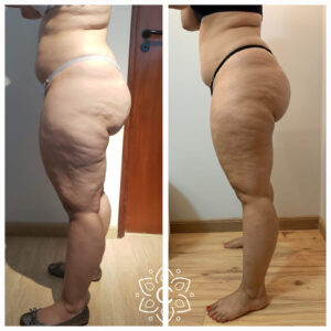 ANTES-E-DEPOIS-2