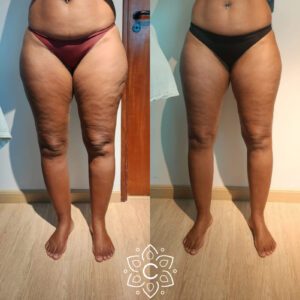 ANTES-E-DEPOIS-3