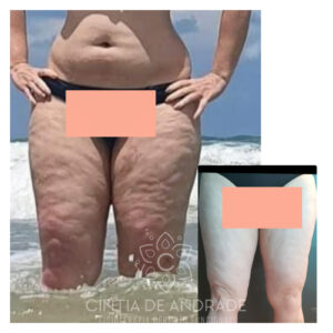 ANTES-E-DEPOIS-4